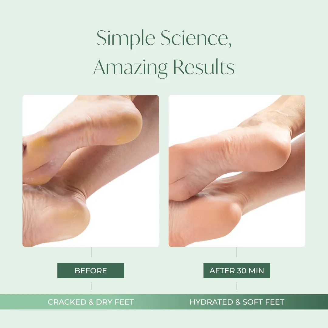 Hydrating Foot Mask